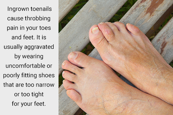 know about the relation between ingrown toenails and foot pain