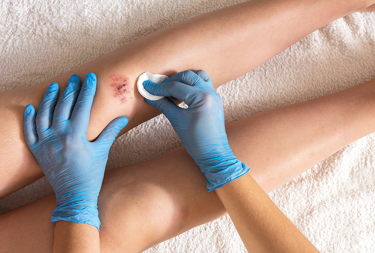 wound care tips for people with diabetes