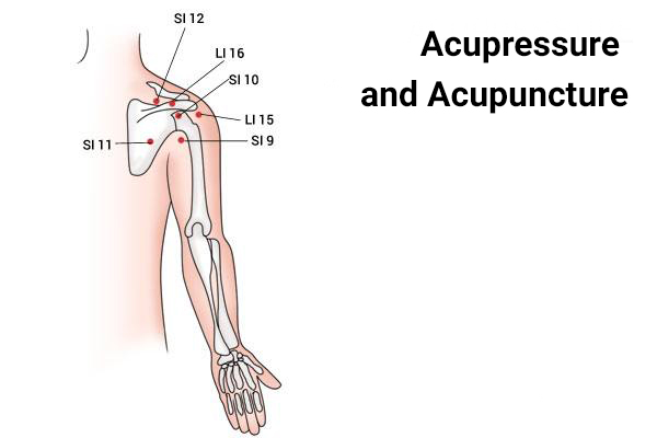 acupressure and acupuncture therapy can help provide shoulder pain relief