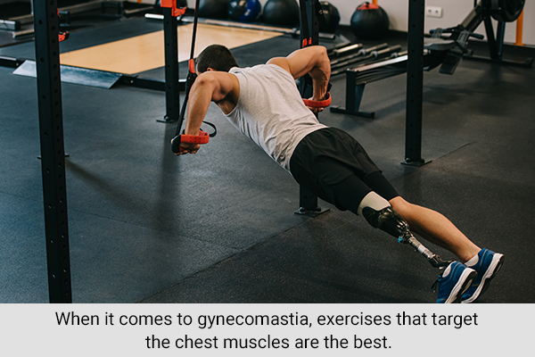 chest-muscle targeting exercises can help reduce gynecomastia