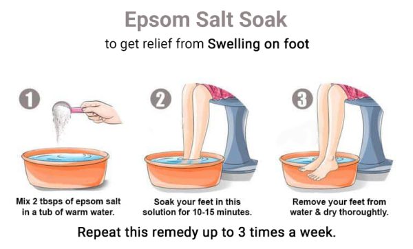 using an Epsom salt soak can help reduce swelling from an injury