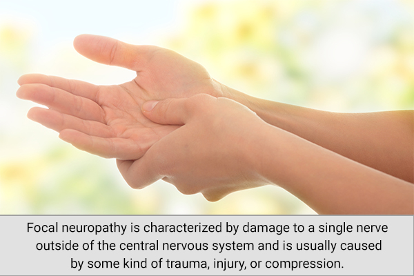 what you need to know about focal neuropathy