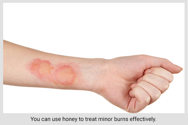 honey can also be used topically to treat minor burns