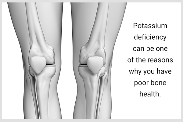 poor bone health is a sign of potassium deficiency