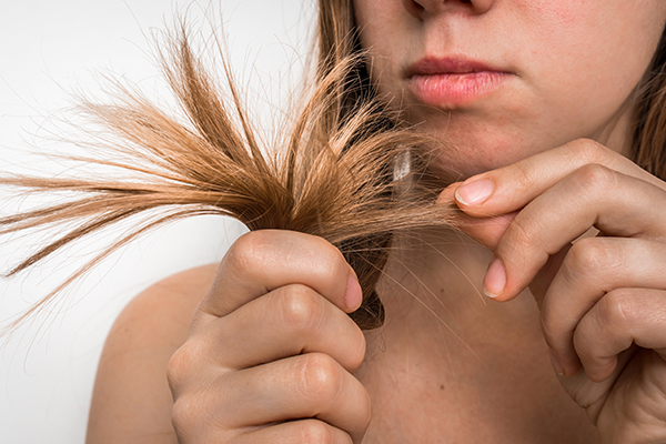 Ringworm Hair Loss: Signs, Causes & Treatments | Longevita