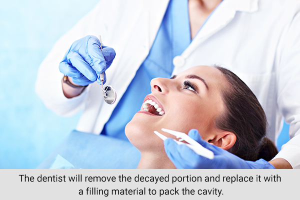 treatment for tooth decay and cavities