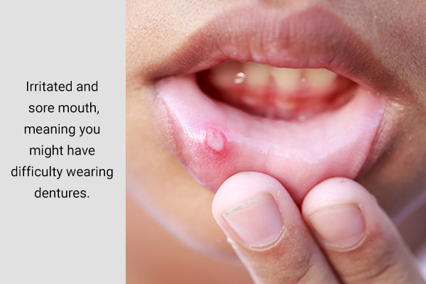 common oral health problems