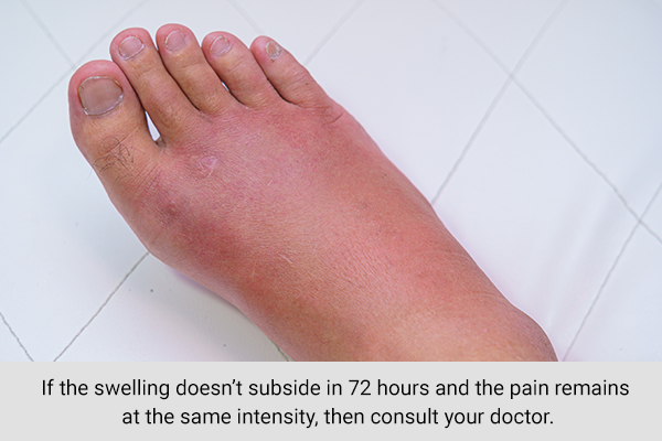 when to consult a doctor regarding injury-related swelling