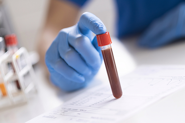 why is it important to get the mentioned health screening tests?