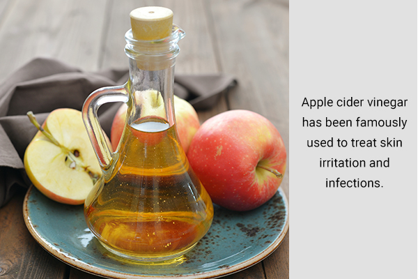 applying apple cider vinegar can help soothe dengue rashes
