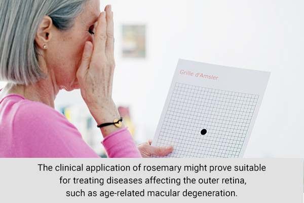 clinical application of rosemary can help prevent macular degeneration