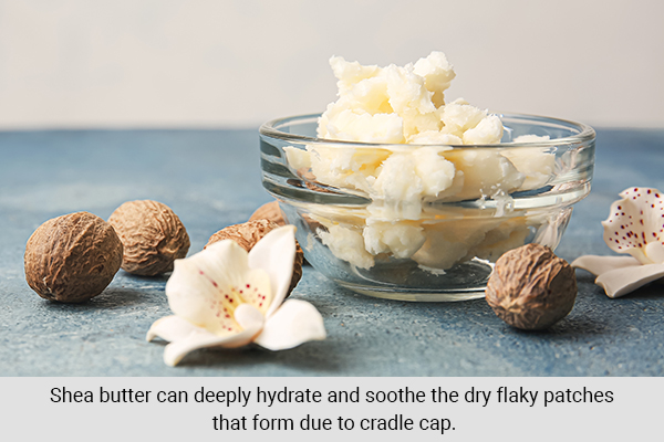 using shea butter can help hydrate the skin and help remove cradle cap
