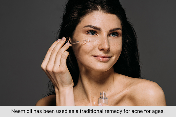 neem oil has been used as a traditional remedy for acne
