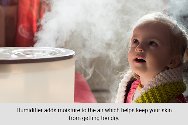 use a humidifier to help prevent dry skin and cradle cap