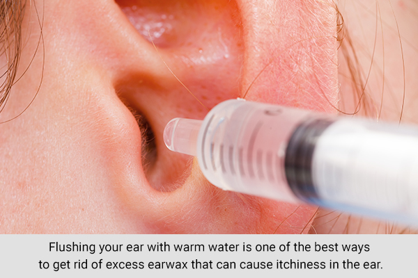 flushing your ear with warm water can help reduce itchiness
