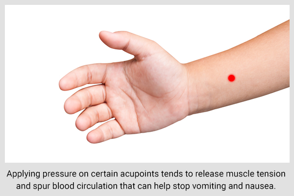 using acupressure therapy can be helpful in relieving nausea and vomiting