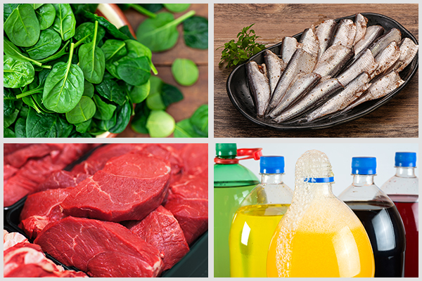 oxalate-rich foods, sardines, red meat, and carbonated drinks can increase kidney stone risk