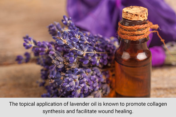 lavender oil can help accelerate wound and scar healing
