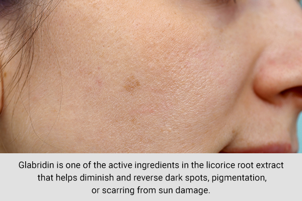 using licorice extract can help treat sun-induced pigmentation