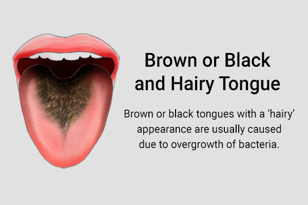 brown/black and hairy tongue could be indicative of bacterial overgrowth