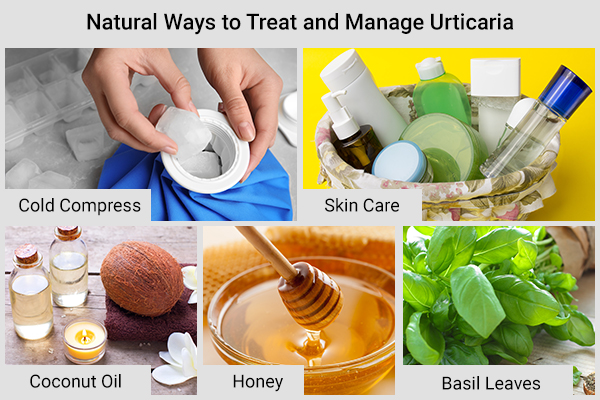 natural measures to treat and manage urticaria