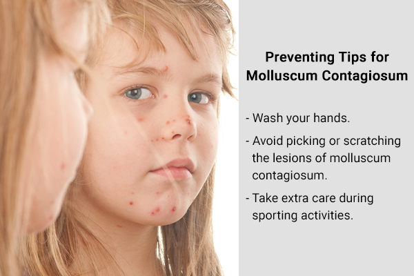 preventive tips against molluscum contagiosum