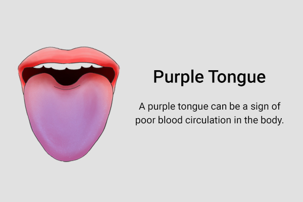 a purple tongue can be a sign of poor blood circulation in the body