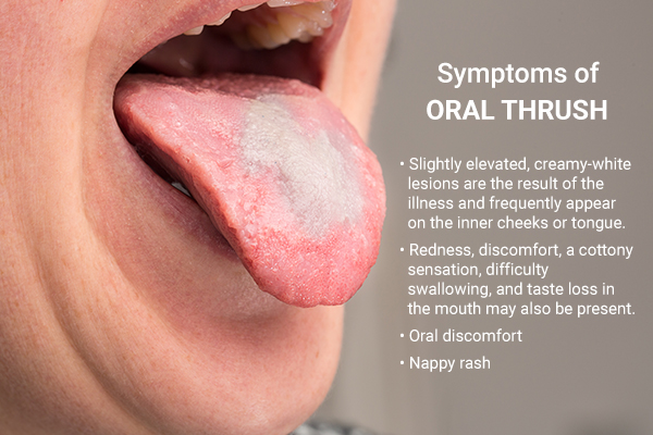 signs and symptoms indicative of oral thrush