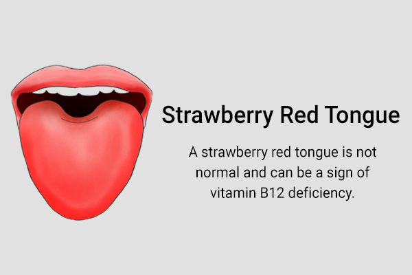 a strawberry red tongue hue could be a sign of vitamin b12 deficiency