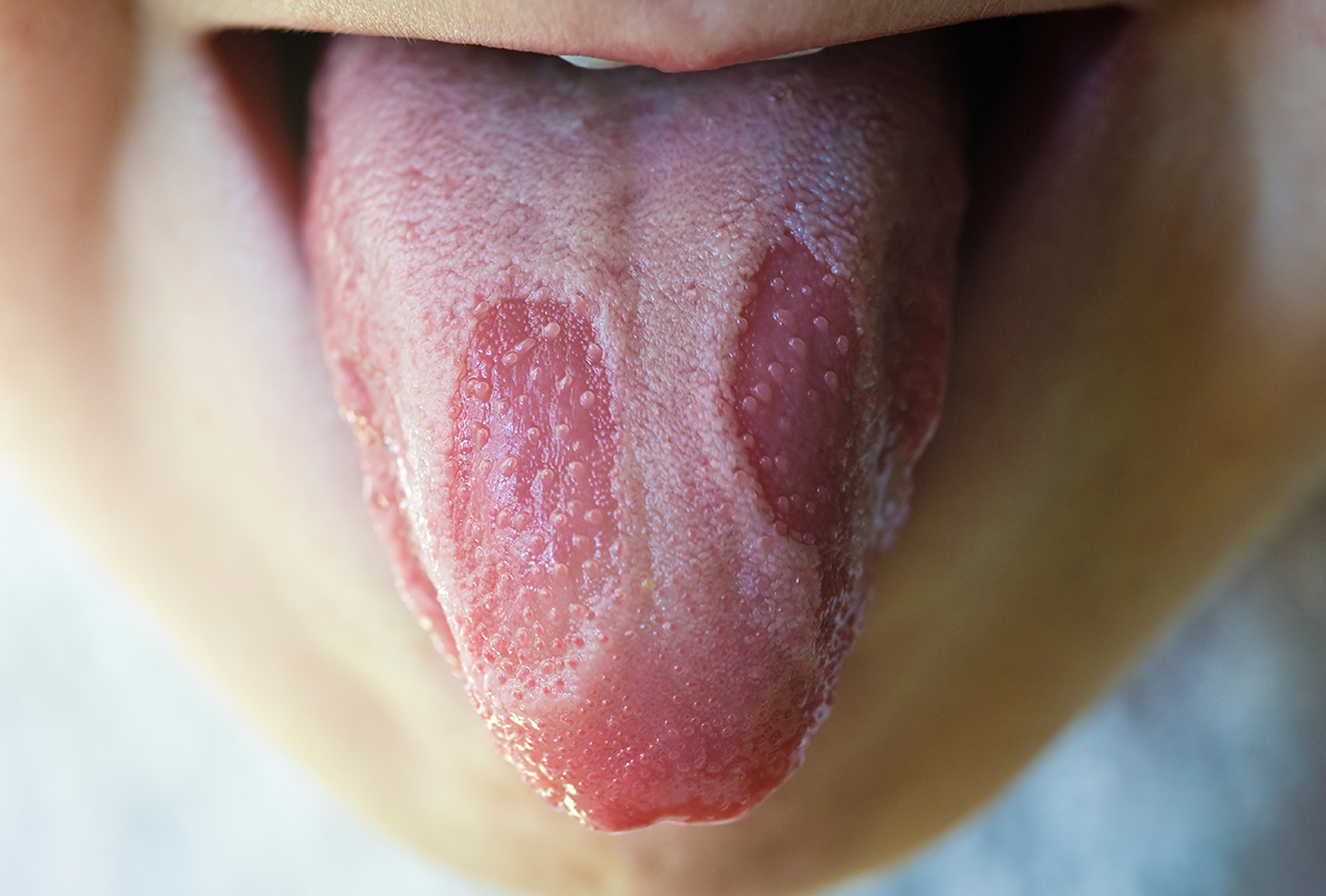 things your tongue can reveal about your health?