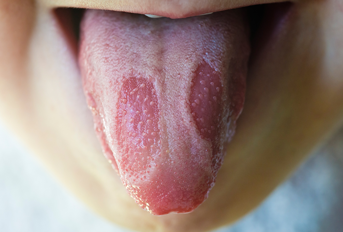 healthy tongue color