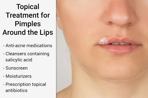 topical treatment modalities for pimples around lips