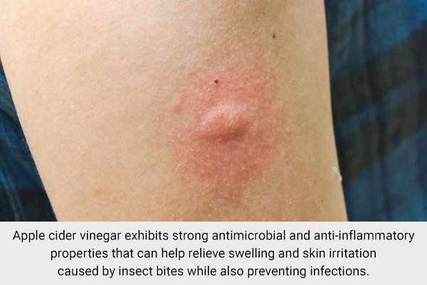 apple cider vinegar can be used to soothe insect bites