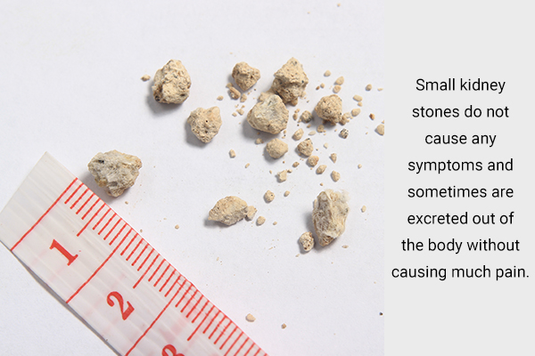 common signs and symptoms of kidney stones
