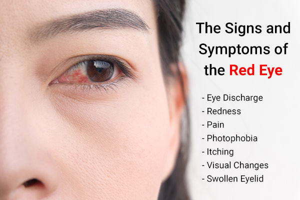 signs and symptoms of eye redness