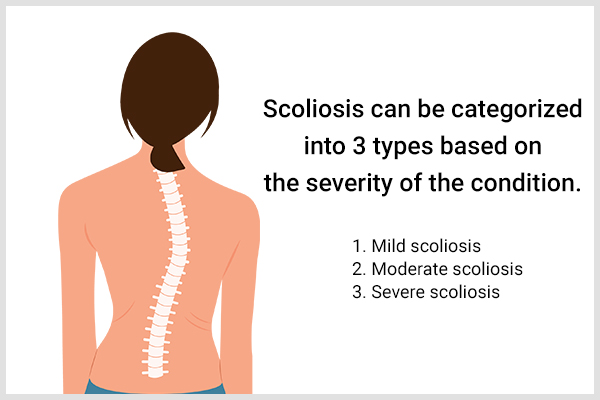classification of scoliosis based on severity