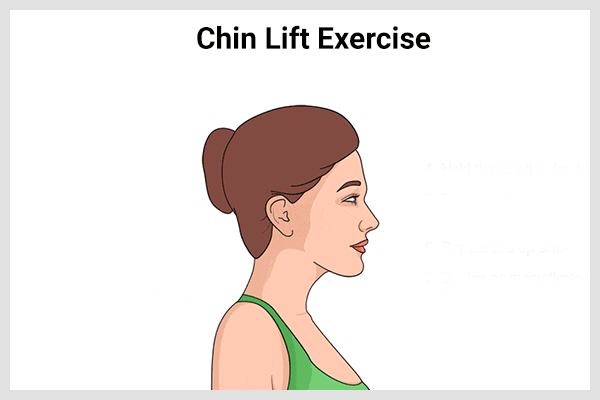 how to do chin lift exercise to get rid of chubby cheeks naturally