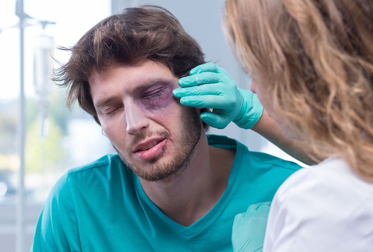 How to Get Rid of a Black Eye Quickly and Effectively