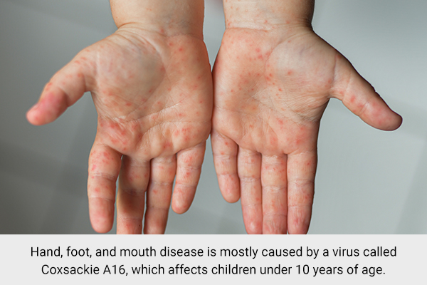 hand, foot, and mouth disease can also lead to pimples on throat