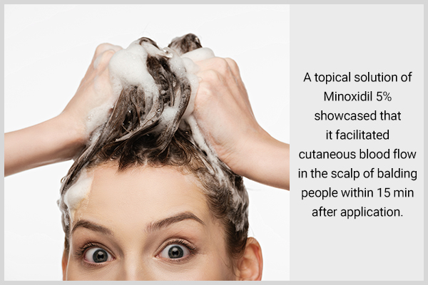 how long to keep minoxidil shampoo on your scalp?