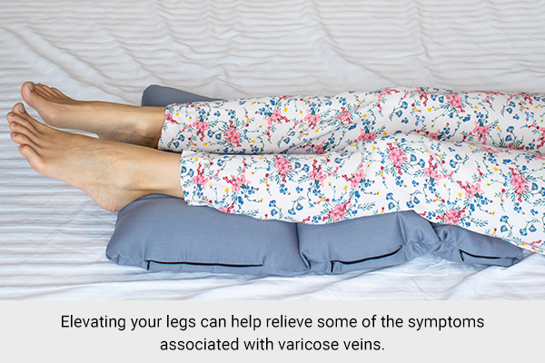 elevating your legs can help relieve spider veins issue
