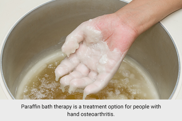 paraffin bath therapy is a treatment option for hand osteoarthritis