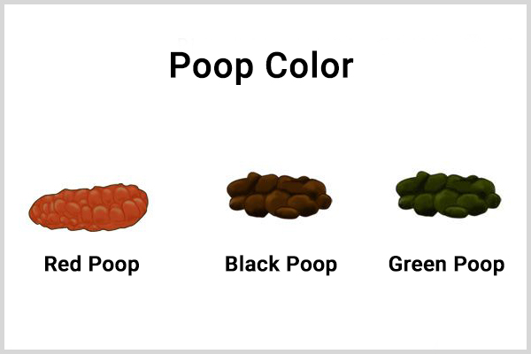 your poop color can reveal things like colon issues, intestinal bleeding, etc.