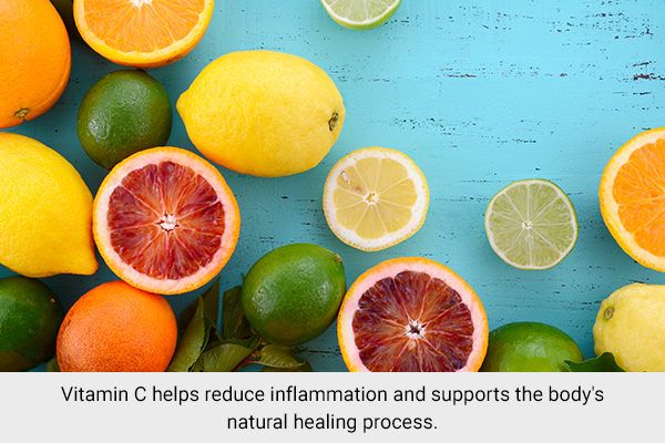 ensuring adequate vitamin C intake can help relieve black eye discomfort
