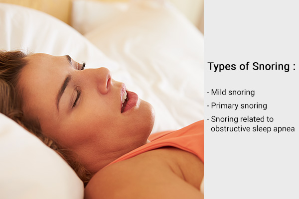 types of snoring based on severity and frequency
