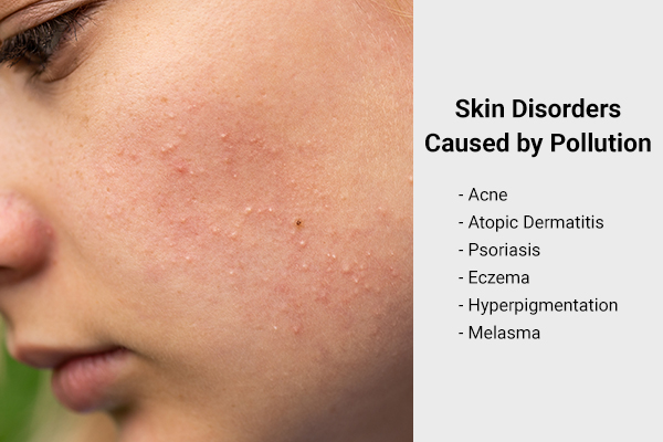 skin disorders caused by pollution