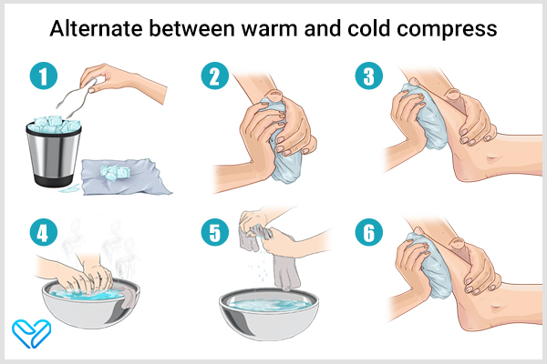 alternate between warm and cold compresses to manage heel spurs