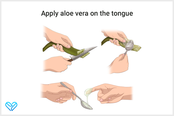 using aloe vera on your tongue can help soothe a sore tongue