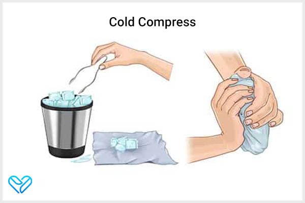 applying a cold compress can soothe chondromalacia patellae