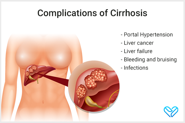 complications associated with liver cirrhosis